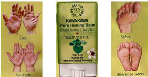 Dầu Kawa Kawa 15g - Pure Healing Balm